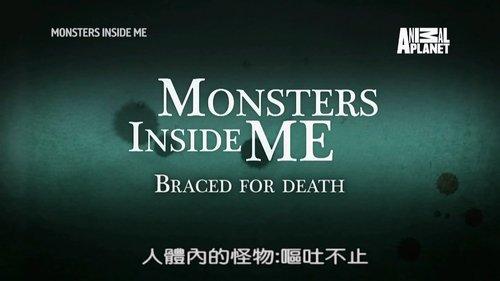 Monsters Inside Me Season 8 Episode 7 - Braced for Death