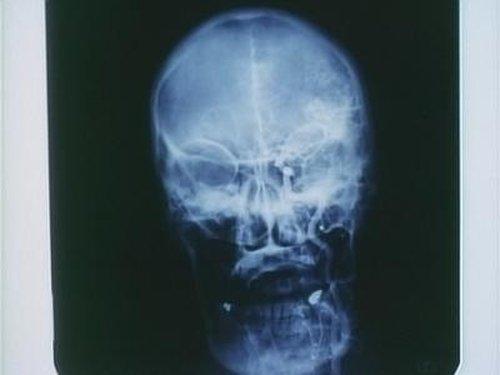 Emergency! Season 4 Episode 3 - Gossip