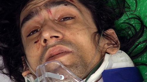 24 Hours in A&E Season 14 Episode 6 - Collision Course