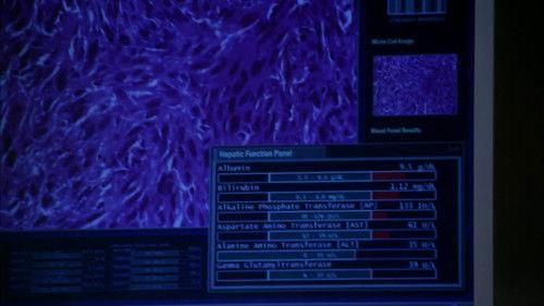 Private Practice Season 3 Episode 8 - Sins of the Father