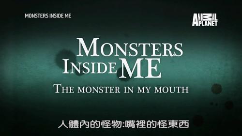 Monsters Inside Me Season 8 Episode 4 - The Monster in My Mouth
