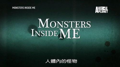 Monsters Inside Me Season 7 Episode 6 - My Evil Twin is Driving Me Crazy