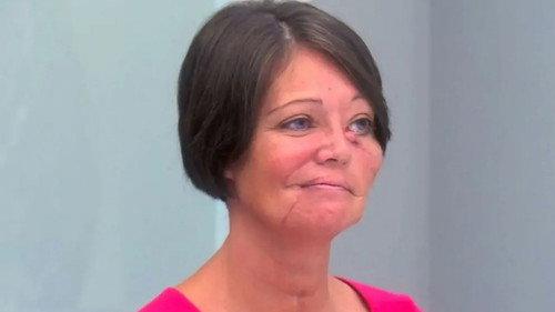 Botched Season 6 Episode 18 - Hopeful Transformations