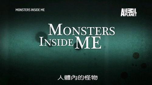 Monsters Inside Me Season 7 Episode 3 - There's Something Living In My Hand!