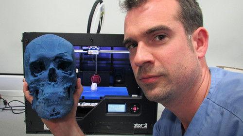 Operation Ouch! Season 3 Episode 4 - My Blue Skull