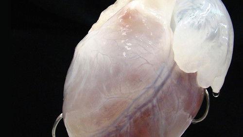 NOVA scienceNOW Season 5 Episode 2 - Can We Live Forever?