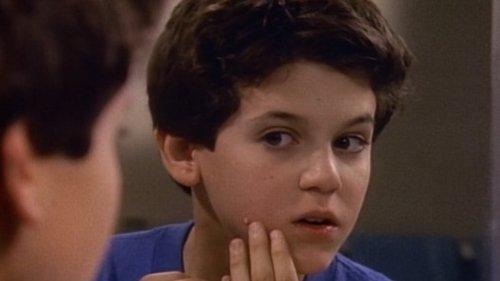 The Wonder Years Season 3 Episode 8 - The Pimple
