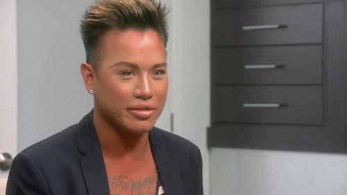 Botched Season 4 Episode 7 - Lumpy Lady Lumps