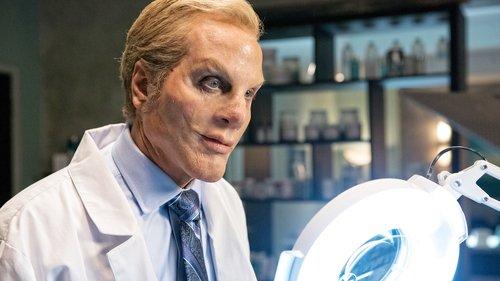 undefined Season 5 Episode 15 - Skin Deep