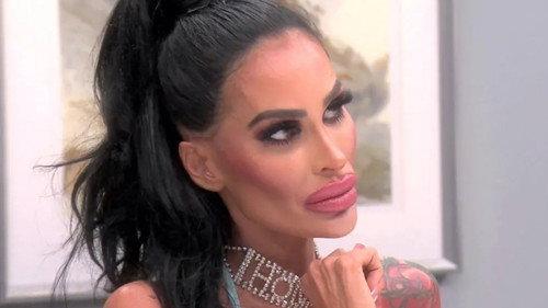 Botched Season 6 Episode 19 - Necrotic Nightmare