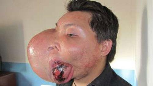 Body Bizarre Season 6 Episode 12 - My New Face