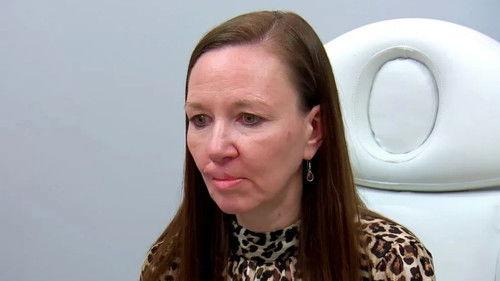 Botched Season 7 Episode 11 - Go With the Toe