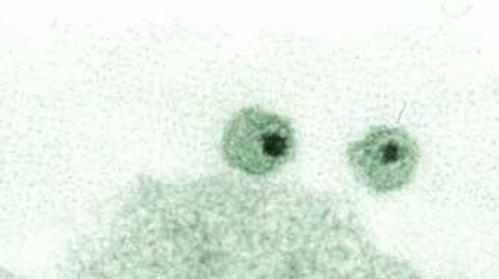 Frontline Season 24 Episode 13 - The Age of AIDS (1)