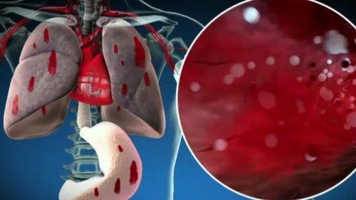 1000 Ways to Die Season 3 Episode 19 - Killing Them Softly