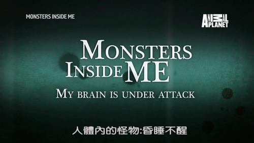 Monsters Inside Me Season 8 Episode 2 - My Brain Is Under Attack