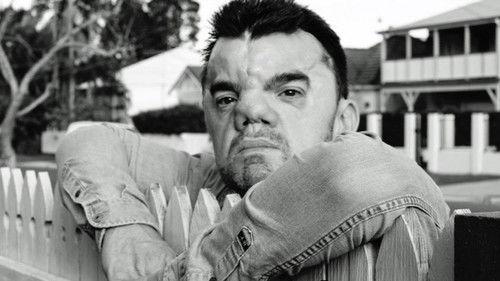 Australian Story Season 20 Episode 21 - In Your Face