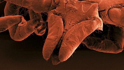 Catalyst Season 17 Episode 21 - Toxic Ticks