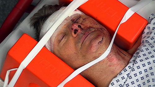 24 Hours in A&E Season 20 Episode 9 - Pride & Prejudice