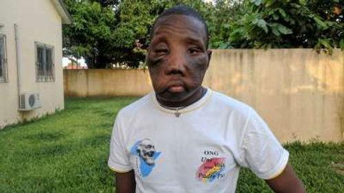 Body Bizarre Season 6 Episode 1 - Burning Inside Out