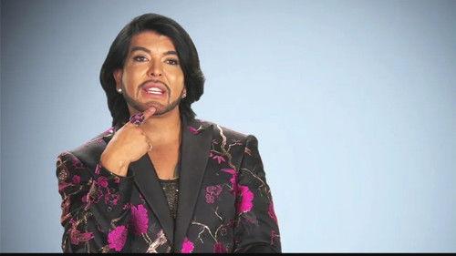 Botched Season 6 Episode 8 - Face Misfor-chin