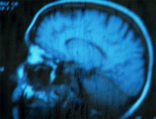 NOVA Season 37 Episode 7 - What Are Dreams?