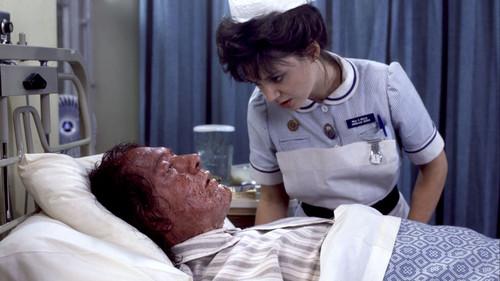 The Singing Detective Season 1 Episode 1 - Skin