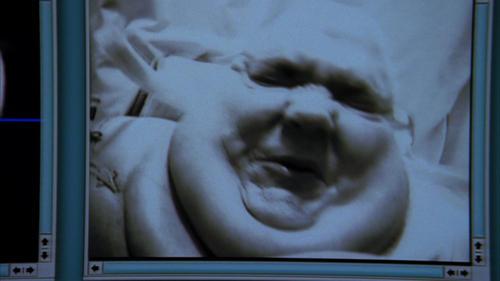 House Season 3 Episode 6 - Que Será Será