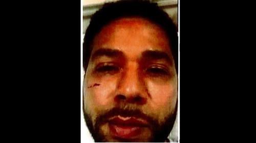 Jussie Smollett: Anatomy of a Hoax Season 1 Episode 1 - The "Attack"