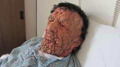 Body Bizarre Season 2 Episode 9 - Bubble Man Meets the Pope