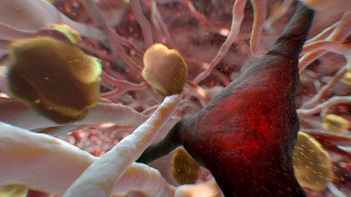 NOVA Season 43 Episode 19 - Can Alzheimer's Be Stopped?