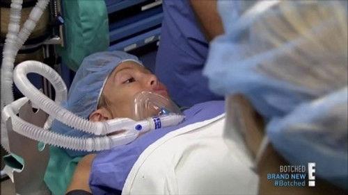 Botched Season 1 Episode 3 - Vagina Bomb!