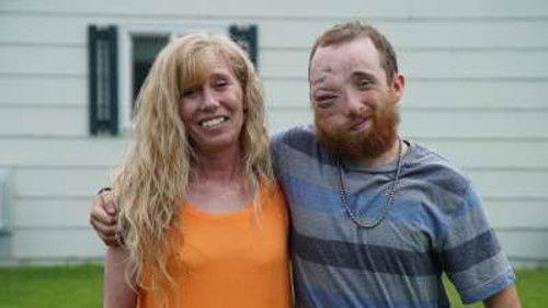 Body Bizarre Season 6 Episode 20 - Born Joined At The Head