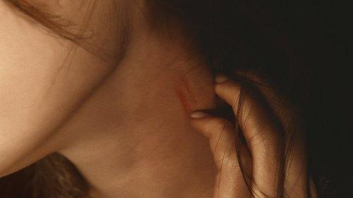 Terapist Season 1 Episode 6 - Episode 6