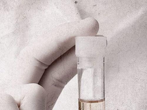 True Nordic Crimes Season 1 Episode 6 - African Beauty