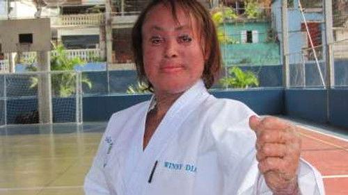 Body Bizarre Season 6 Episode 15 - World's Fattest Baby