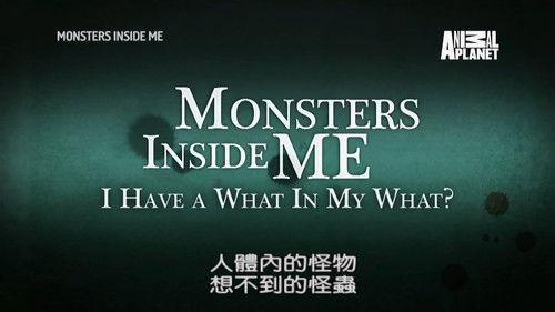 Monsters Inside Me Season 7 Episode 2 - I Have a What in my What?