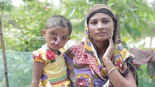 Body Bizarre Season 6 Episode 19 - My Dwarf Baby