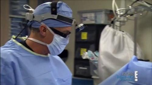 Botched Season 1 Episode 6 - Boob Freak!