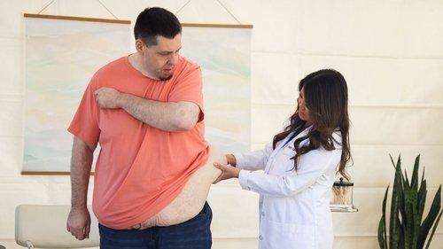 Dr. Pimple Popper Season 9 Episode 7 - Pig Snout