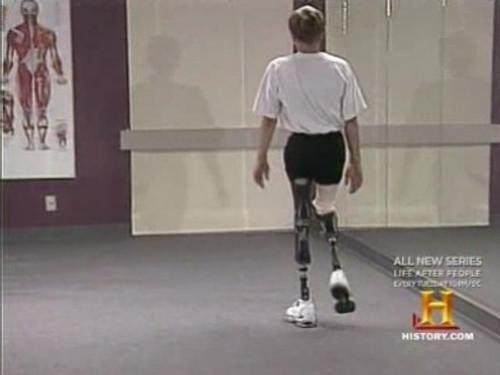 Modern Marvels Season 6 Episode 14 - Prosthetics