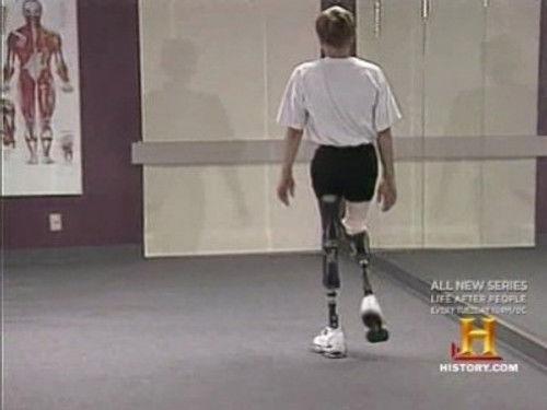 Modern Marvels Season 6 Episode 14 - Prosthetics