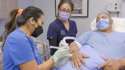 Dr. Pimple Popper Season 8 Episode 4 - Alligator Arms
