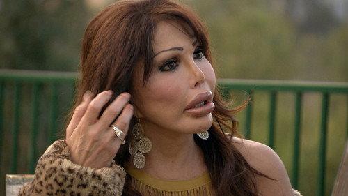 Botched Season 1 Episode 8 - Silicone Valley