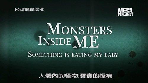 Monsters Inside Me Season 8 Episode 6 - Something Is Eating My Baby