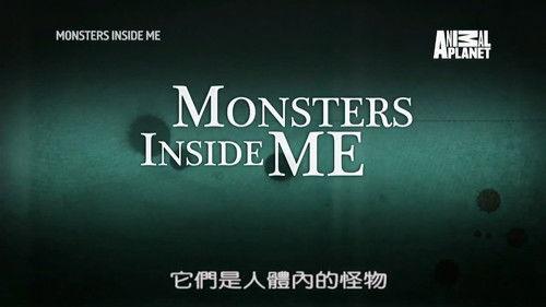 Monsters Inside Me Season 7 Episode 4 - My Wife is Rotting