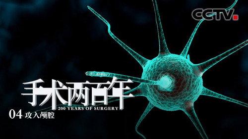 Two Hundred Years of Surgery Season 1 Episode 4 - Exploring the Brain