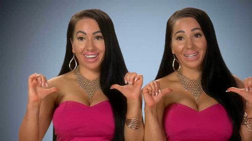 Botched Season 3 Episode 7 - Seeing Double