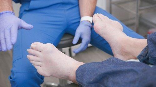 My Feet Are Killing Me Season 4 Episode 2 - Hammerhead Foot