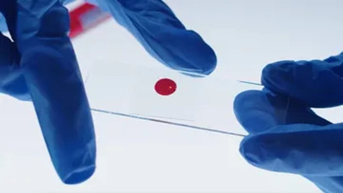 Blood Pattern Analysis