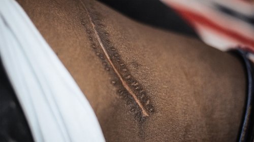 Background image for Exposing the Illegal Organ Trade